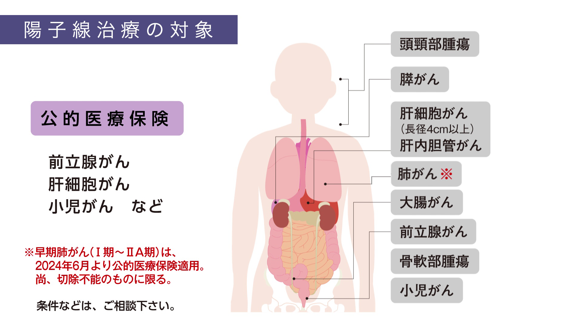 陽子線治療の対象 公的医療保険