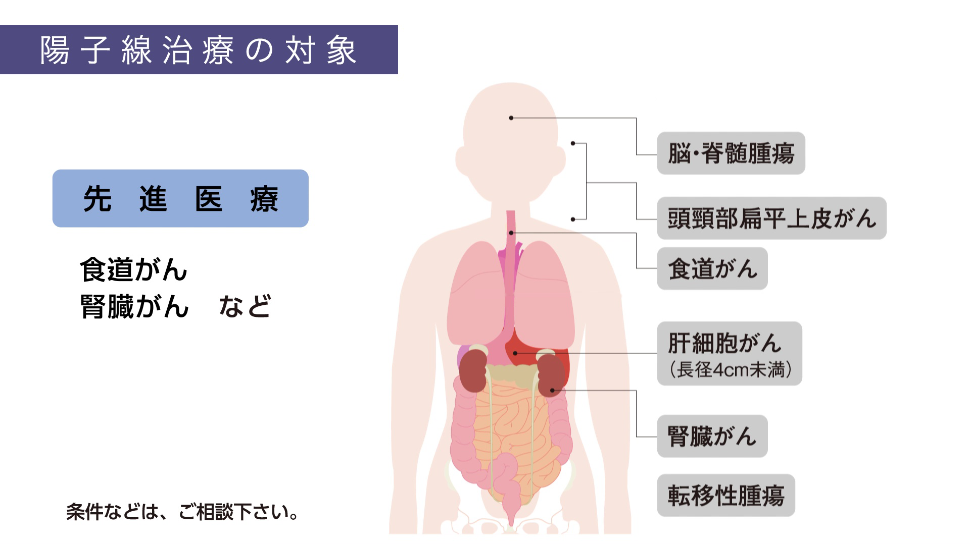 陽子線治療の対象 先進医療