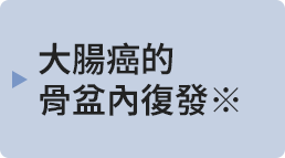 大腸がんの骨盤内再発