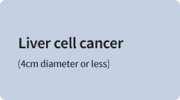 Liver cell cancer